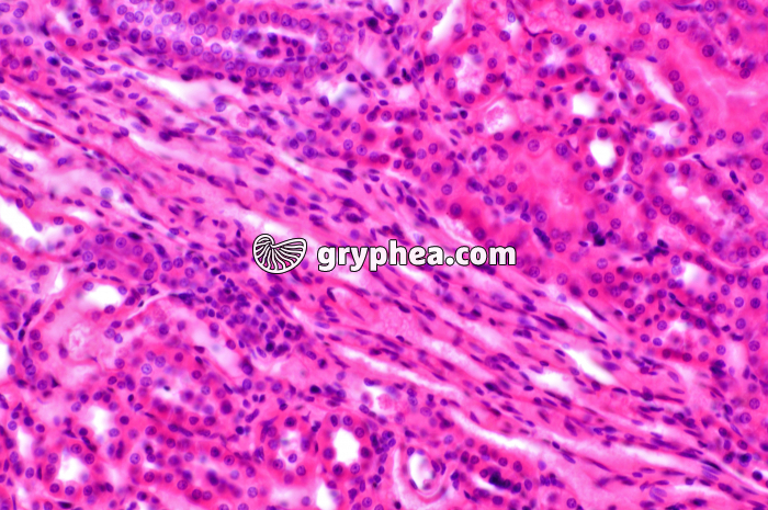 Tubules Rein x100 - gryphea.com